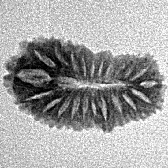 21 Mukhi Rudraksha 17.4mm 0.76gm - Inverse xray