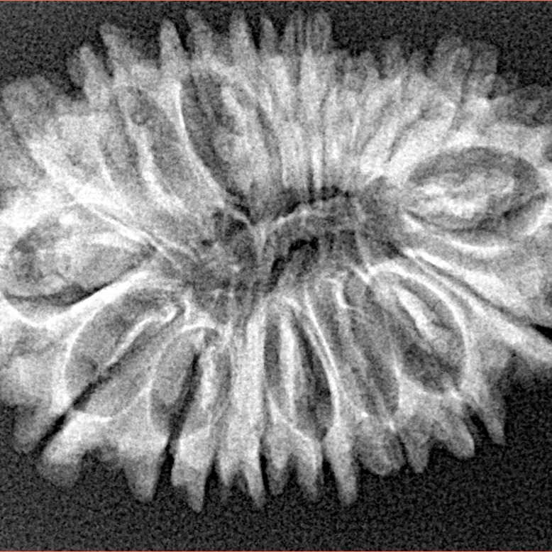 18 Mukhi Rudraksha 31.3mm 4.35gm - Xray