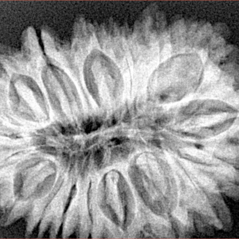 18 Mukhi Rudraksha 33.6mm 6.93gm - Xray