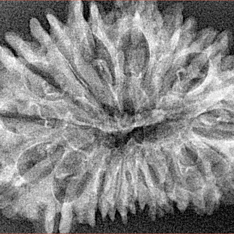 18 Mukhi Rudraksha 33.4mm 3.52gm - Xray