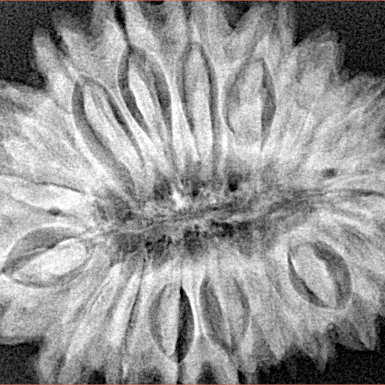 18 Mukhi Rudraksha 32.4mm 6.87gm - Xray