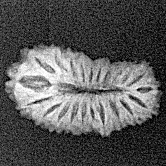 21 Mukhi Rudraksha 17.4mm 0.76gm - Xray