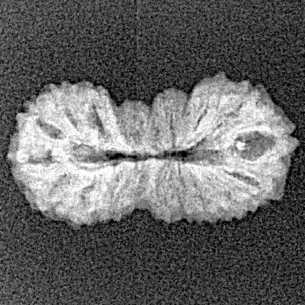 21 Mukhi Rudraksha 19.7mm 0.94gm - Xray