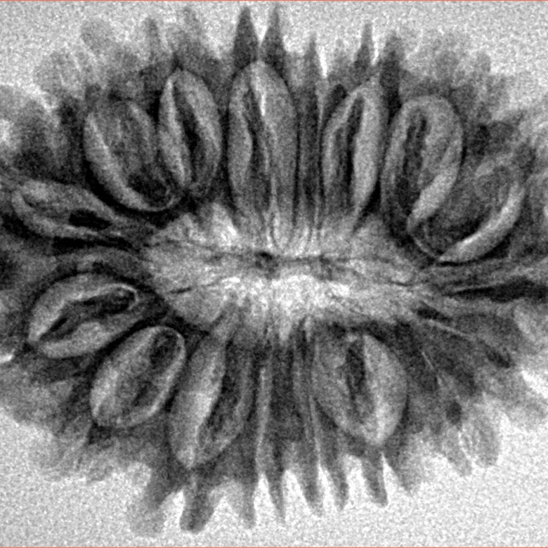 17 Mukhi Rudraksha 31.4mm 4.49gm - Inverse xray
