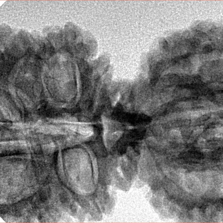 17 Mukhi Gaurishankar 40.9mm 7.16gm - Inverse xray