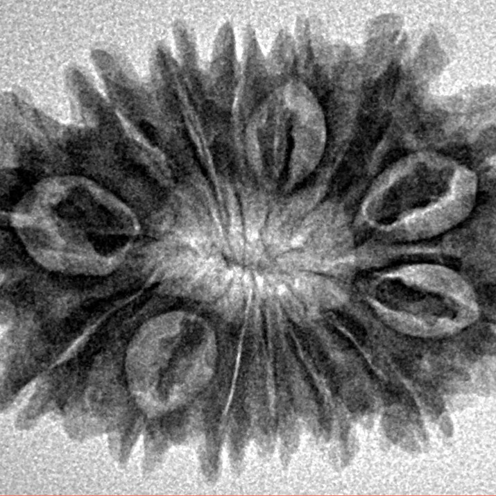 14 Mukhi Rudraksha 28.2mm 4gm - Inverse xray