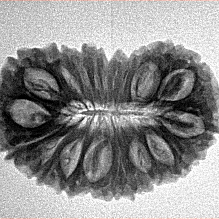 21 Mukhi Rudraksha 26.5mm 3.27gm - Inverse xray