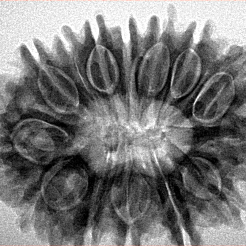 14 Mukhi Rudraksha 32.2mm 6.26gm - Inverse xray