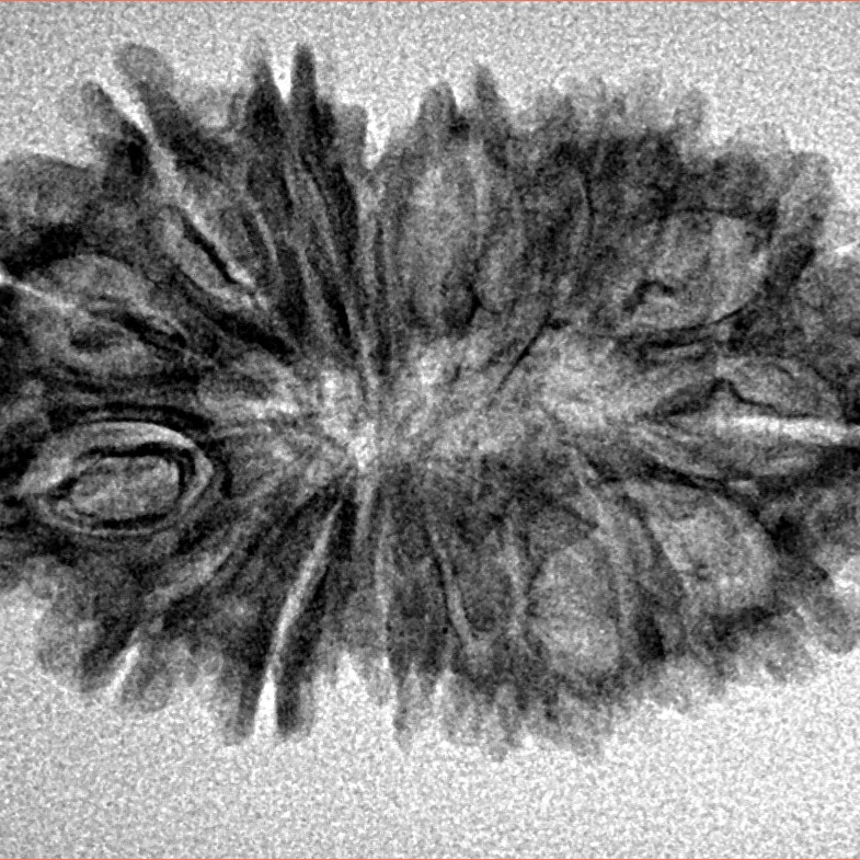 17 Mukhi Rudraksha 30.7mm 3.17gm - Inverse xray