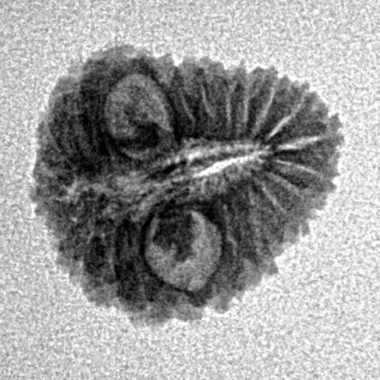 21 Mukhi Rudraksha 15.1mm 0.9gm - Inverse xray