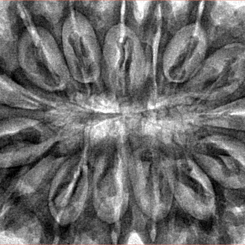 15 Mukhi Rudraksha 40mm 9.47gm - Inverse xray