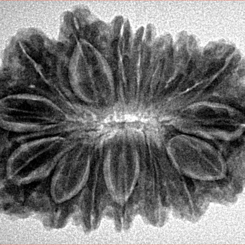 16 Mukhi Rudraksha 32.2mm 5.75gm - Inverse xray