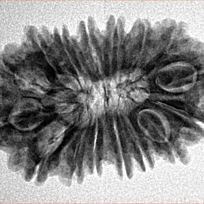 16 Mukhi Rudraksha 28mm 3.72gm - Inverse xray