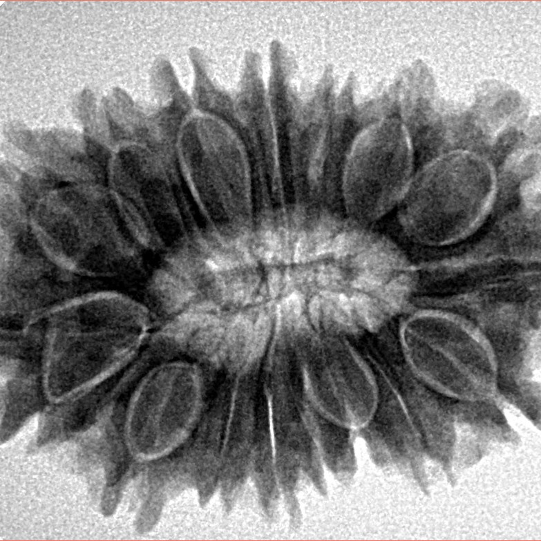 17 Mukhi Rudraksha 30.6mm 5.55gm - Origin: Nepal - Inverse xray