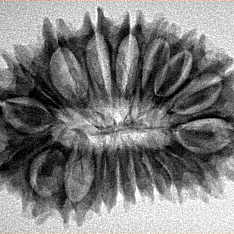 18 Mukhi Rudraksha 31.2mm 4.79gm - Origin: Nepal - Inverse xray