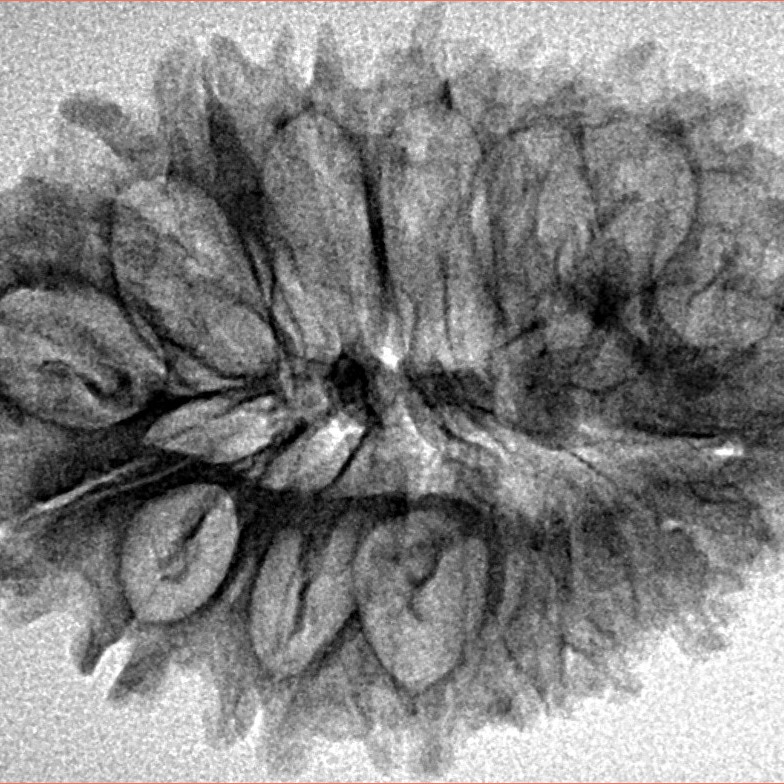 17 Mukhi Rudraksha 33mm 4gm - Inverse xray