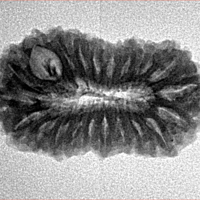 21 Mukhi Rudraksha 25.3mm 2.54gm - Origin: Indonesia - Inverse xray