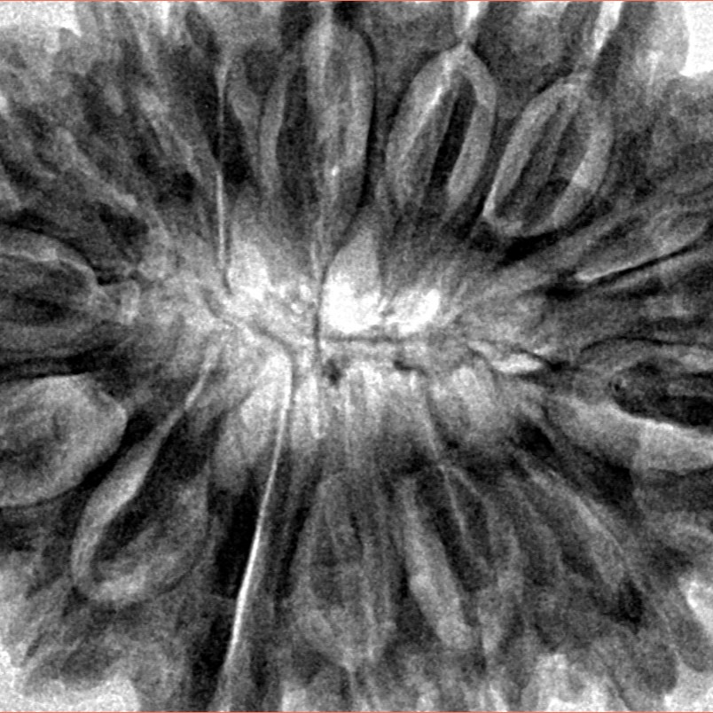 15 Mukhi Rudraksha 38.3mm 9.52gm - Inverse xray