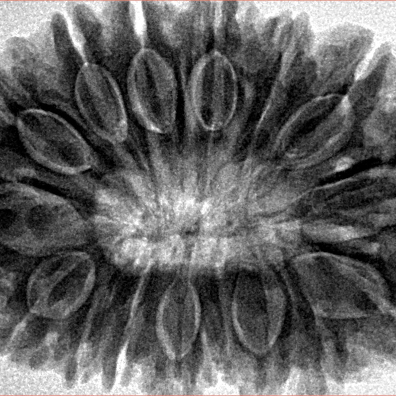 16 Mukhi Rudraksha 35.7mm 9.17gm - Inverse xray