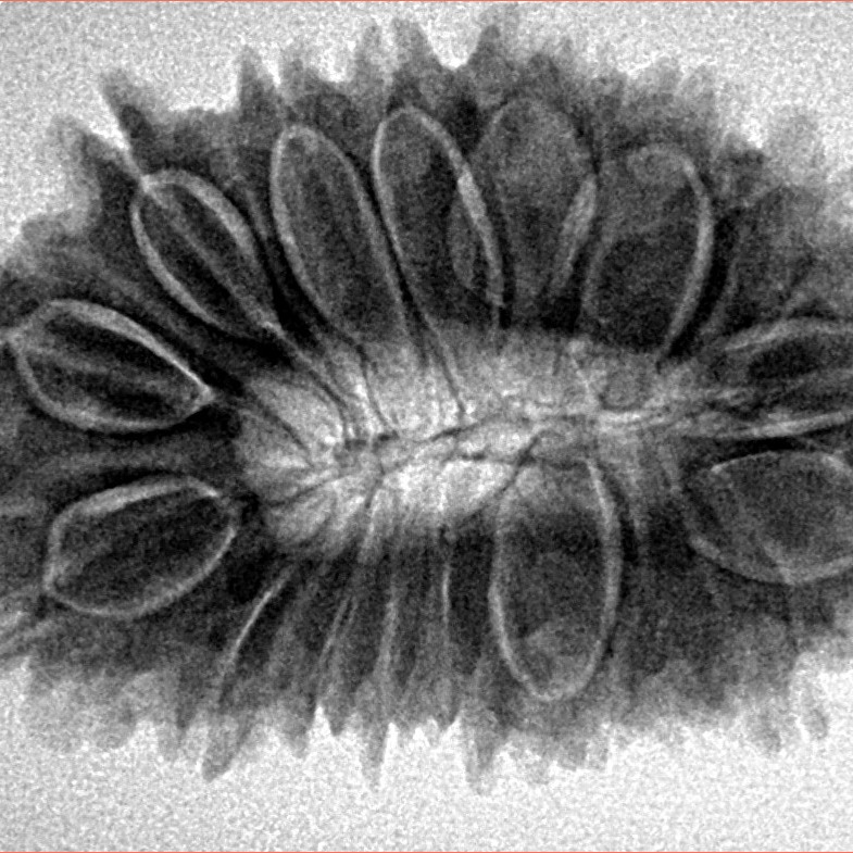 17 Mukhi Rudraksha 32.4mm 5.94gm - Inverse xray