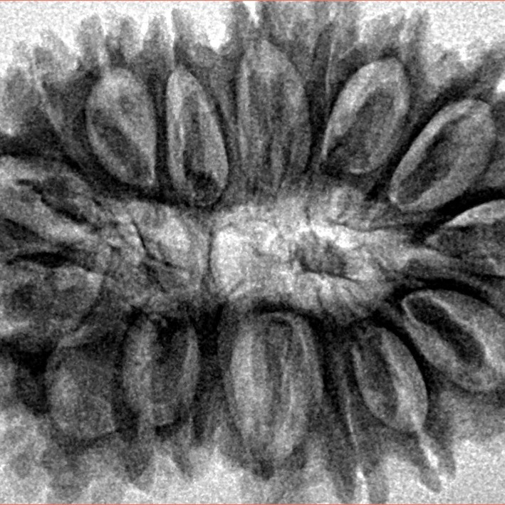 17 Mukhi Rudraksha 32.4mm 5.48gm - Inverse xray