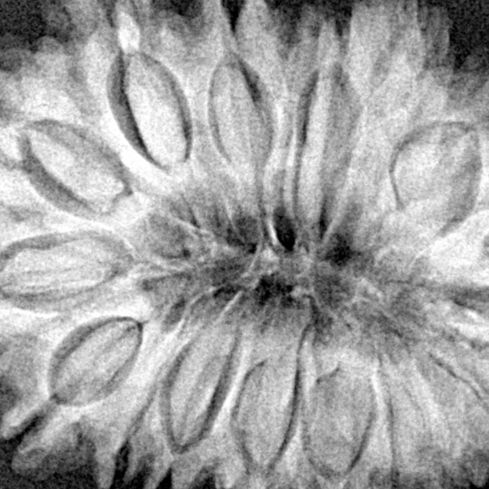 17 Mukhi Rudraksha 34.2mm 7.43gm - Xray