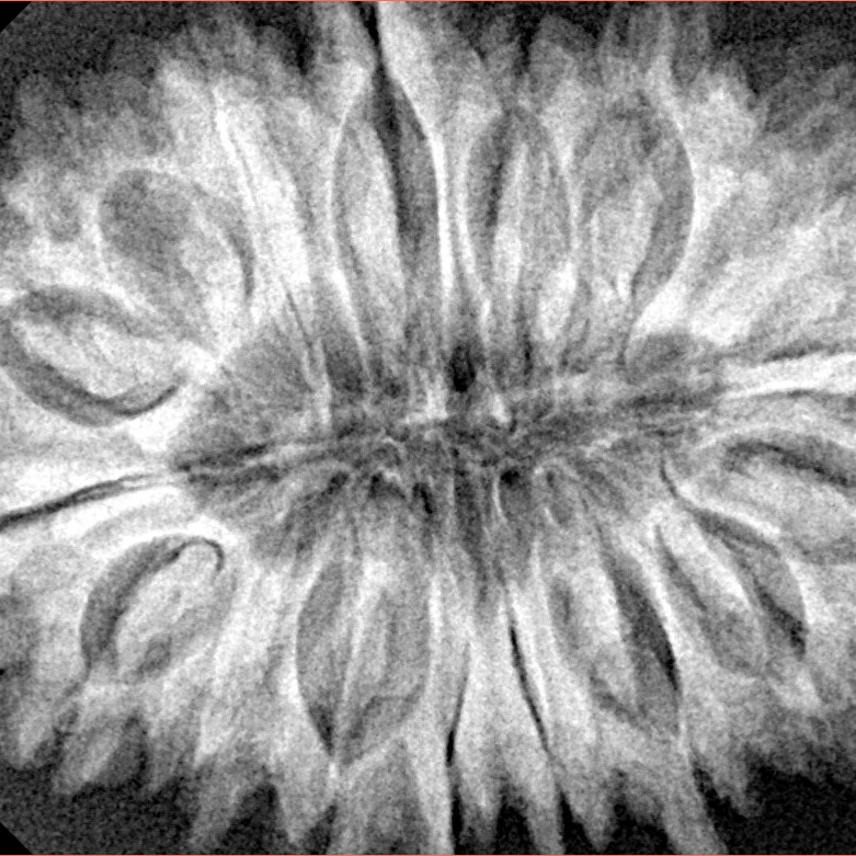 17 Mukhi Rudraksha 35mm 7.49gm - Xray