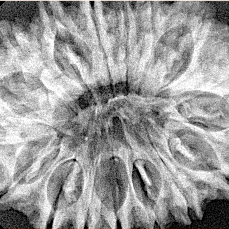 17 Mukhi Rudraksha 34mm 6.55gm - Xray