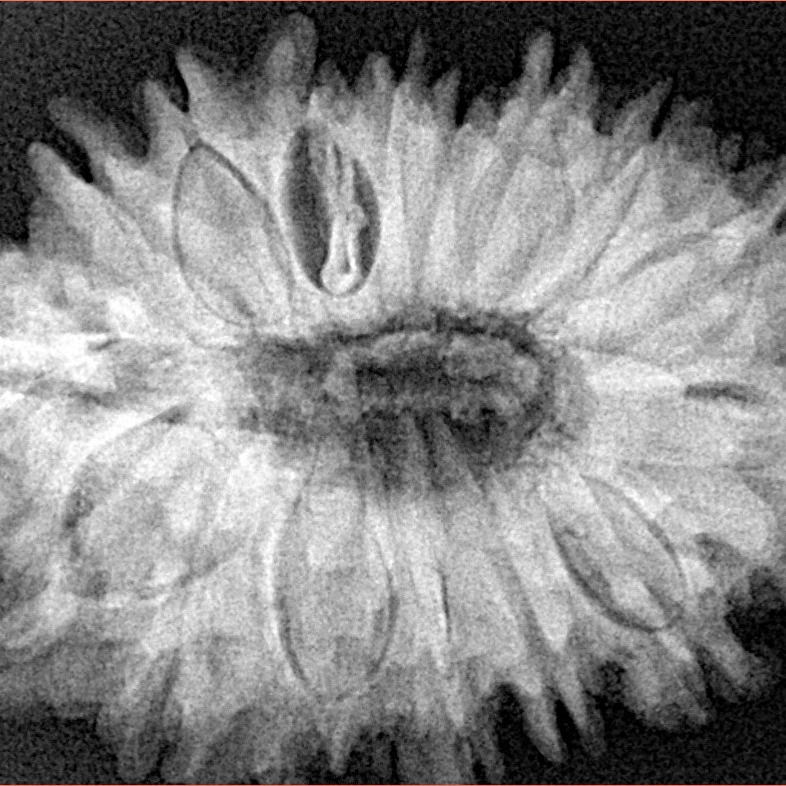 16 Mukhi Rudraksha 33mm 7.27gm - Xray