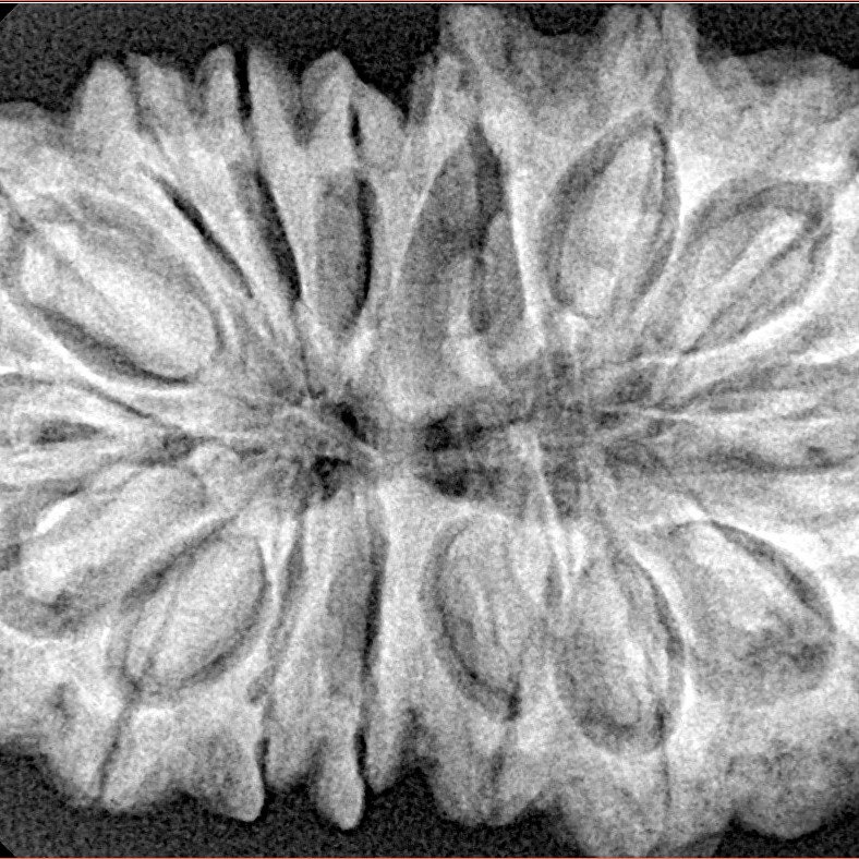 16 Mukhi Rudraksha 36.2mm 7.68gm - Xray