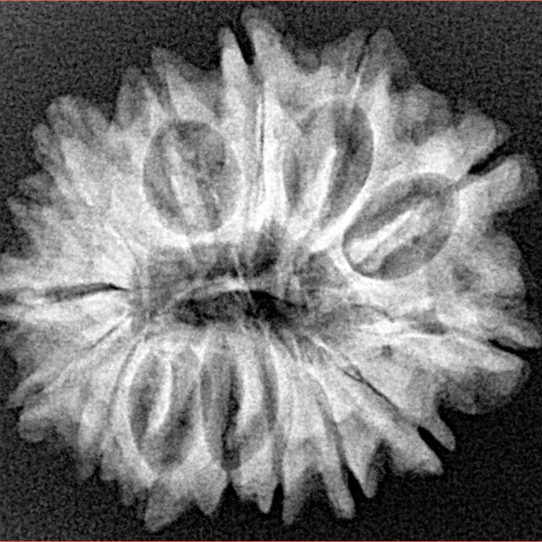 15 Mukhi Rudraksha 26mm 4.17gm - Xray