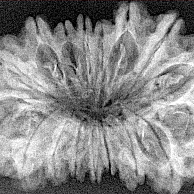 17 Mukhi Rudraksha 35.4mm 4.73gm - Xray