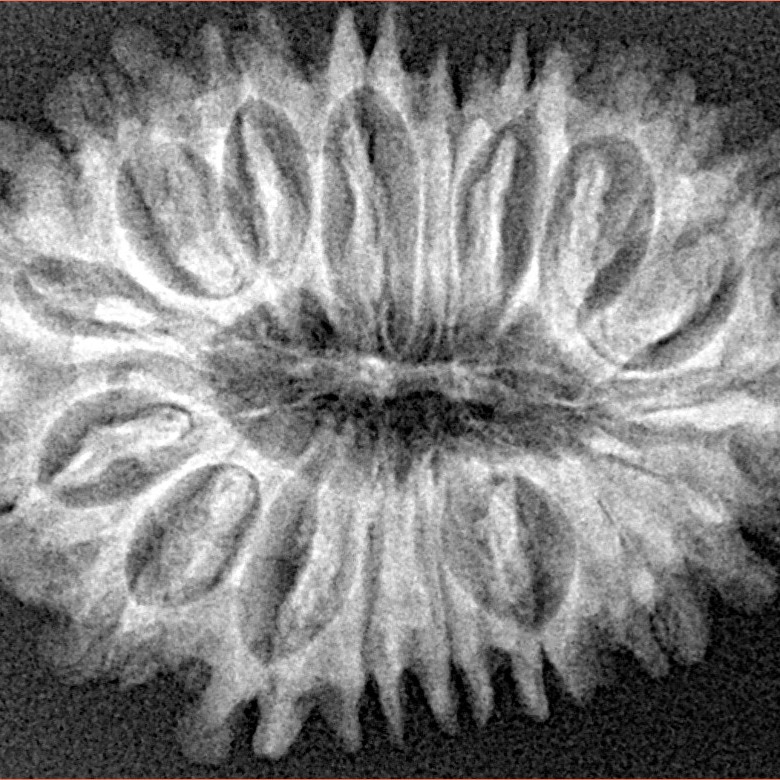 17 Mukhi Rudraksha 31.4mm 4.49gm - Xray