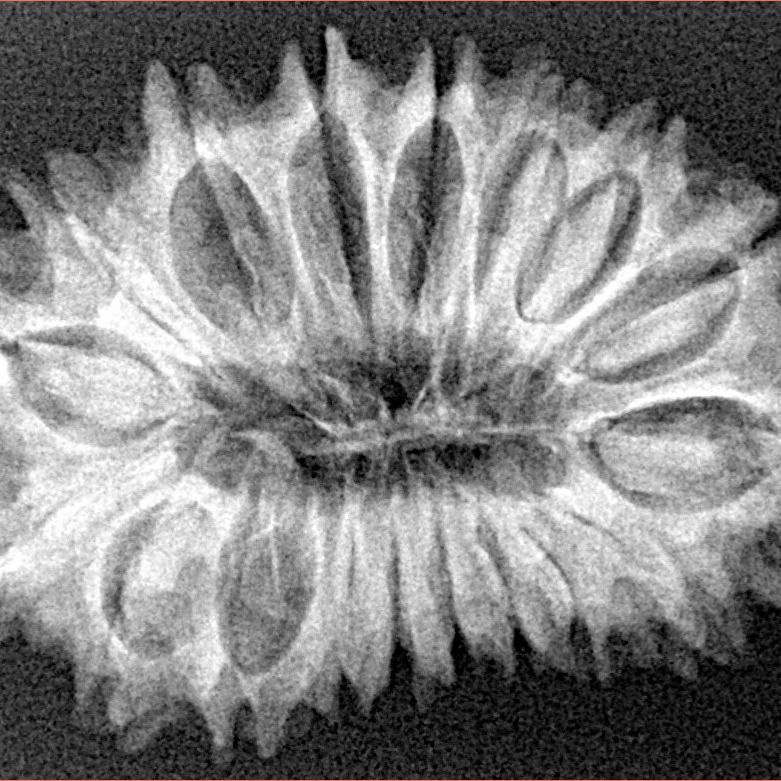 18 Mukhi Rudraksha 31.2mm 4.79gm - Origin: Nepal - Xray