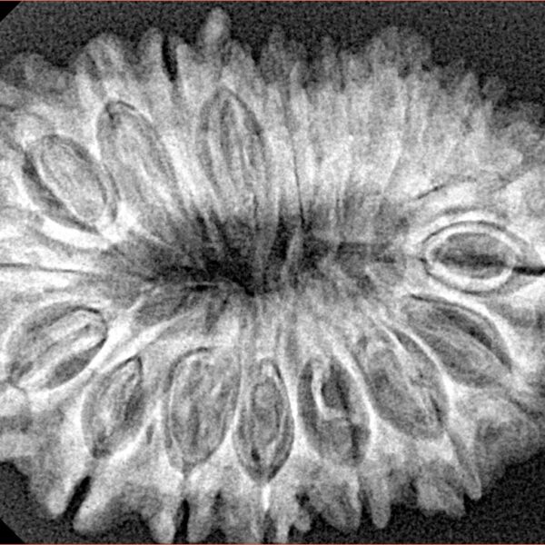 18 Mukhi Rudraksha 31.9mm 5.28gm - Xray