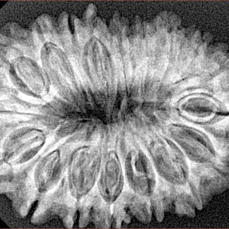 18 Mukhi Rudraksha 31.9mm 5.28gm - Xray