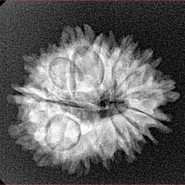 16 Mukhi Rudraksha 23.4mm 2.77gm - Xray