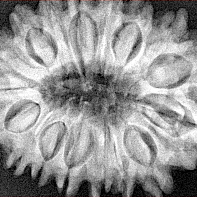 17 Mukhi Rudraksha 33.1mm 7.22gm - Xray