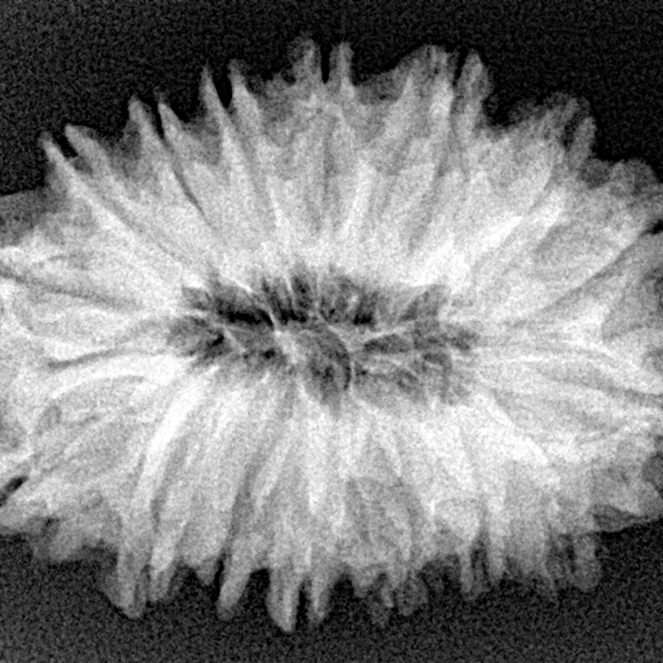 16 Mukhi Rudraksha 30.1mm 5.85gm - Xray