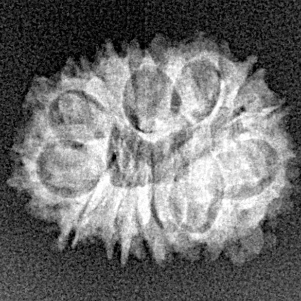 16 Mukhi Rudraksha 19.5mm 1.59gm - Xray