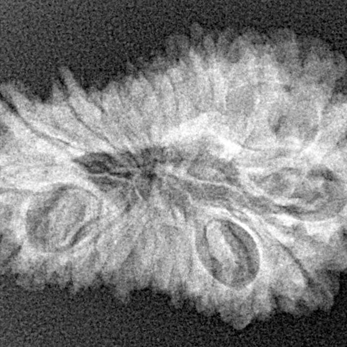 20 Mukhi Rudraksha 30mm 3.58gm - Xray