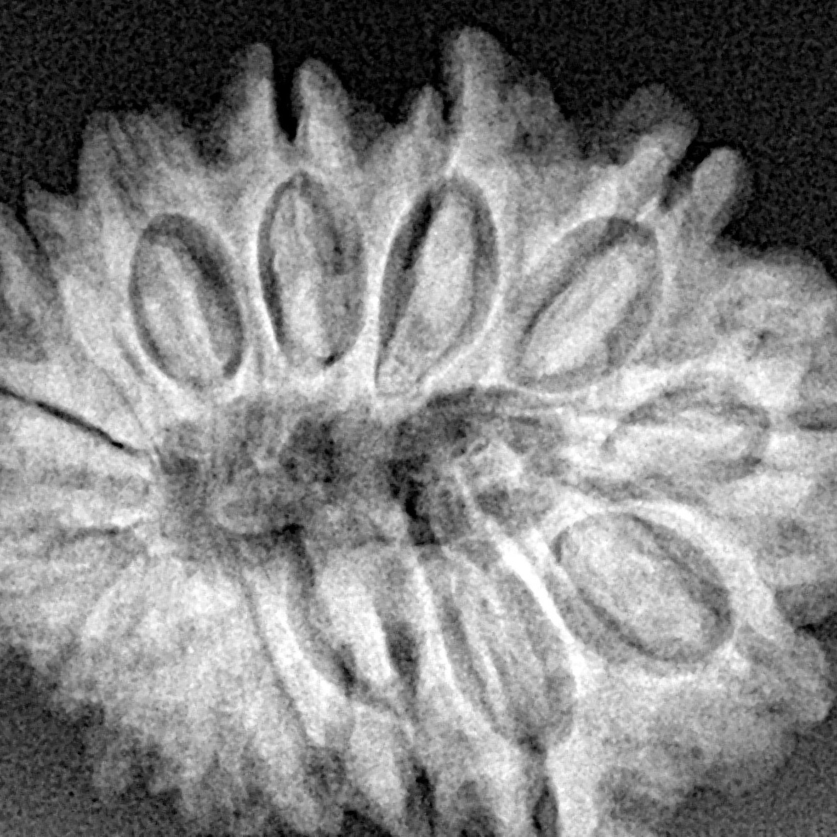 15 Mukhi Rudraksha 27.2mm 4.49gm - Xray