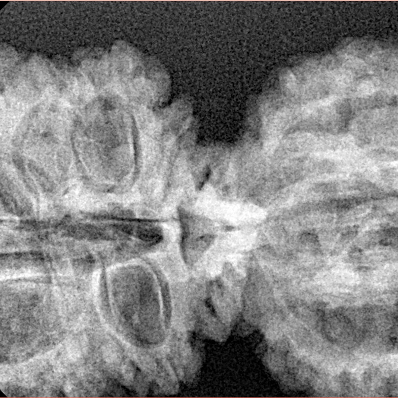 17 Mukhi Gaurishankar 40.9mm 7.16gm - Xray