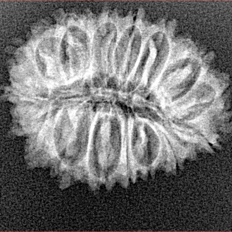 19 Mukhi Rudraksha 23.6mm 2.36gm - Xray
