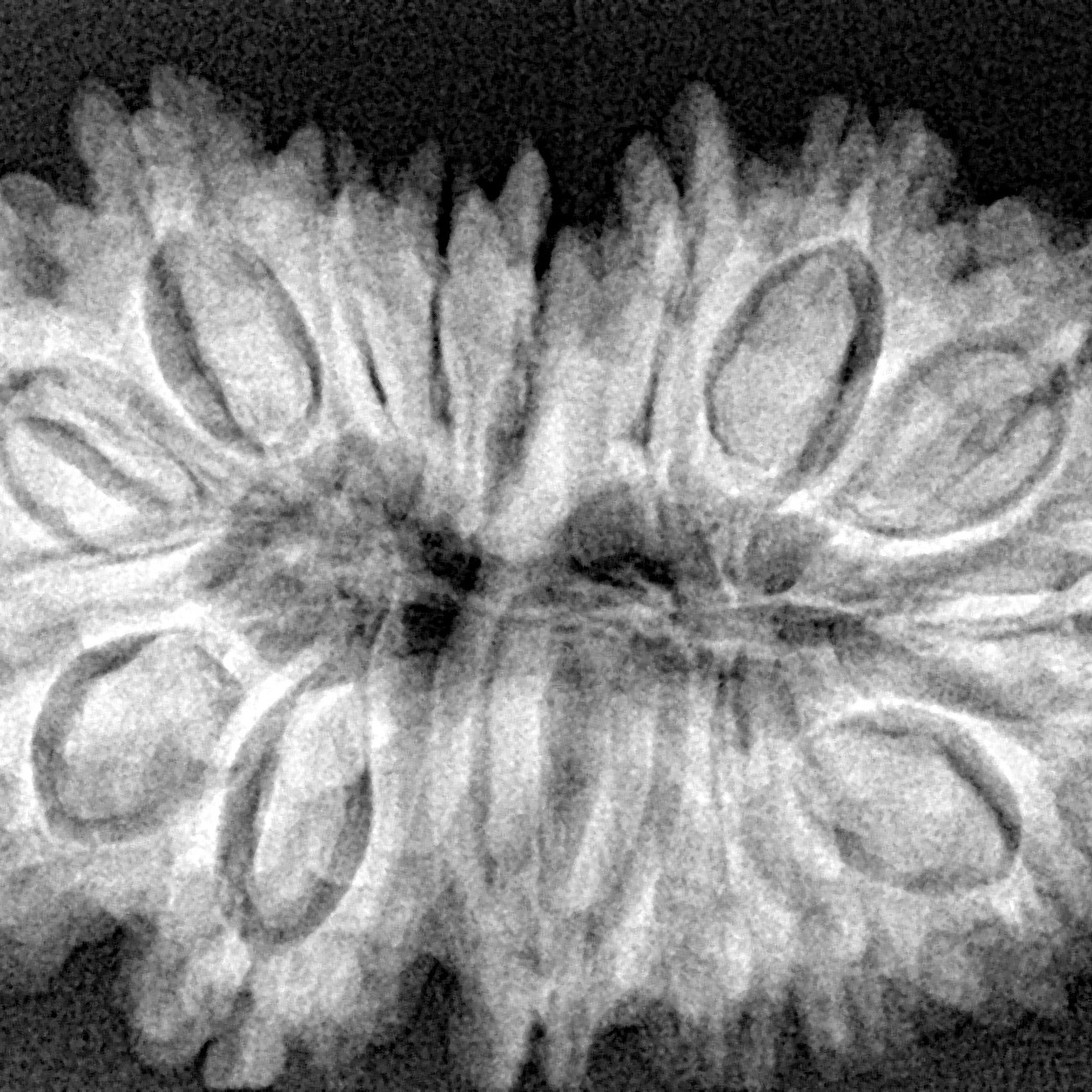 16 Mukhi Rudraksha 34.8mm 6.56gm - Xray