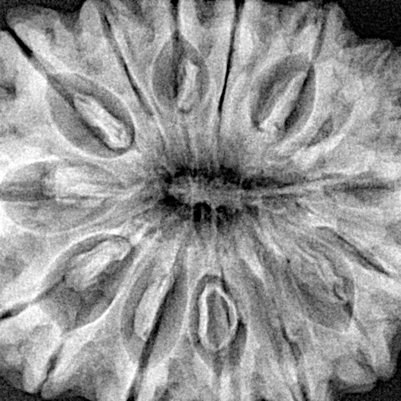 15 Mukhi Rudraksha 33.5mm 8gm - Xray