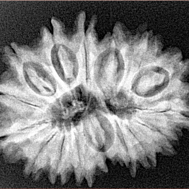 16 Mukhi Rudraksha 28.4mm 5gm - Xray