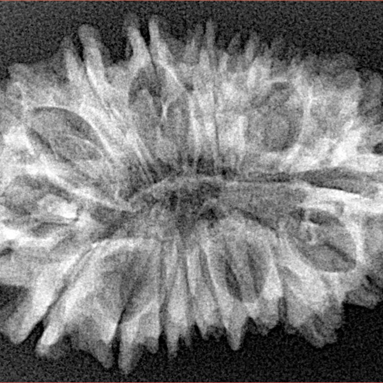 18 Mukhi Rudraksha 32mm 4.31gm - Xray