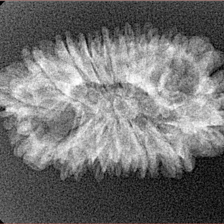 16 Mukhi Rudraksha 28.6mm 2.57gm - Xray