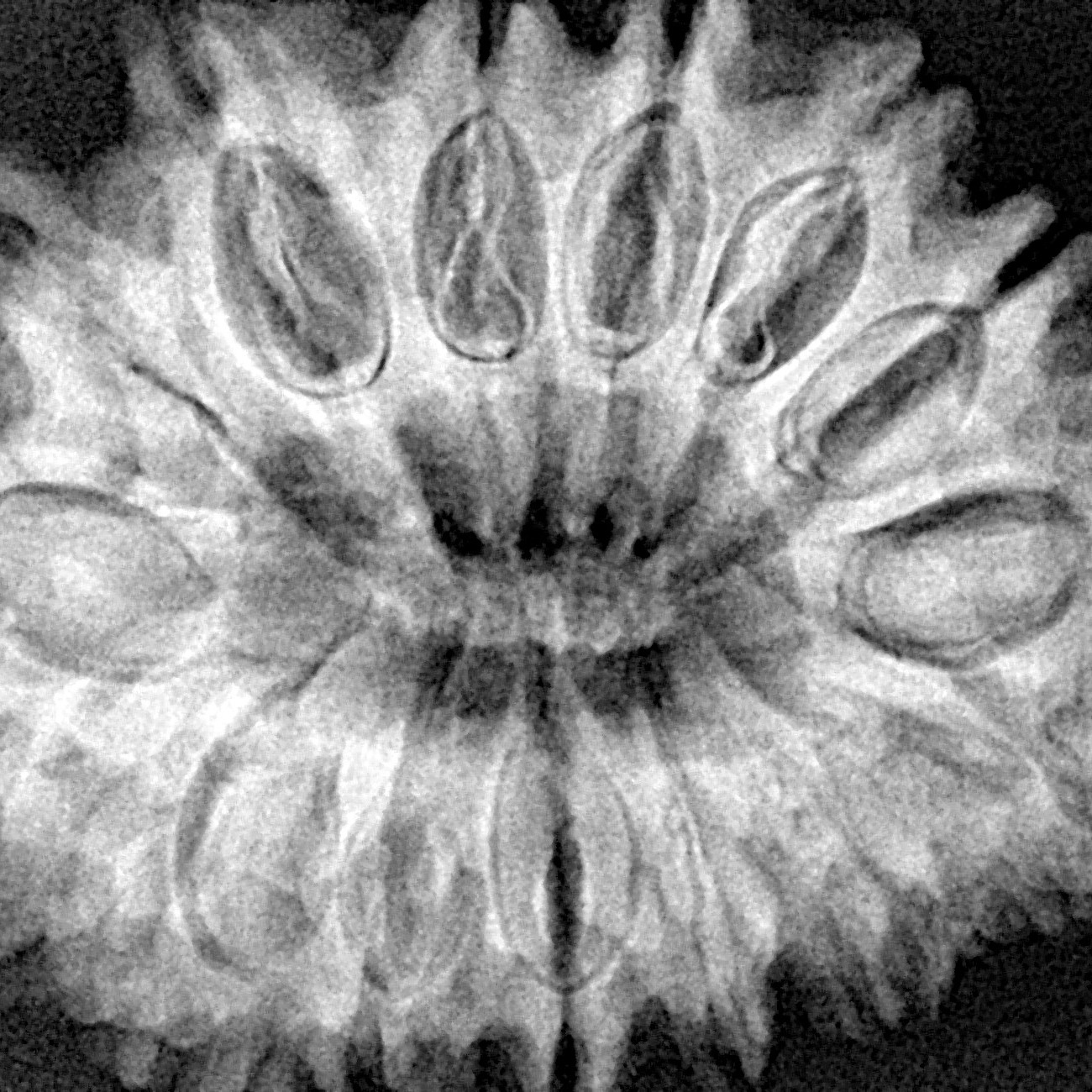 15 Mukhi Rudraksha 33mm 7.27gm - Xray